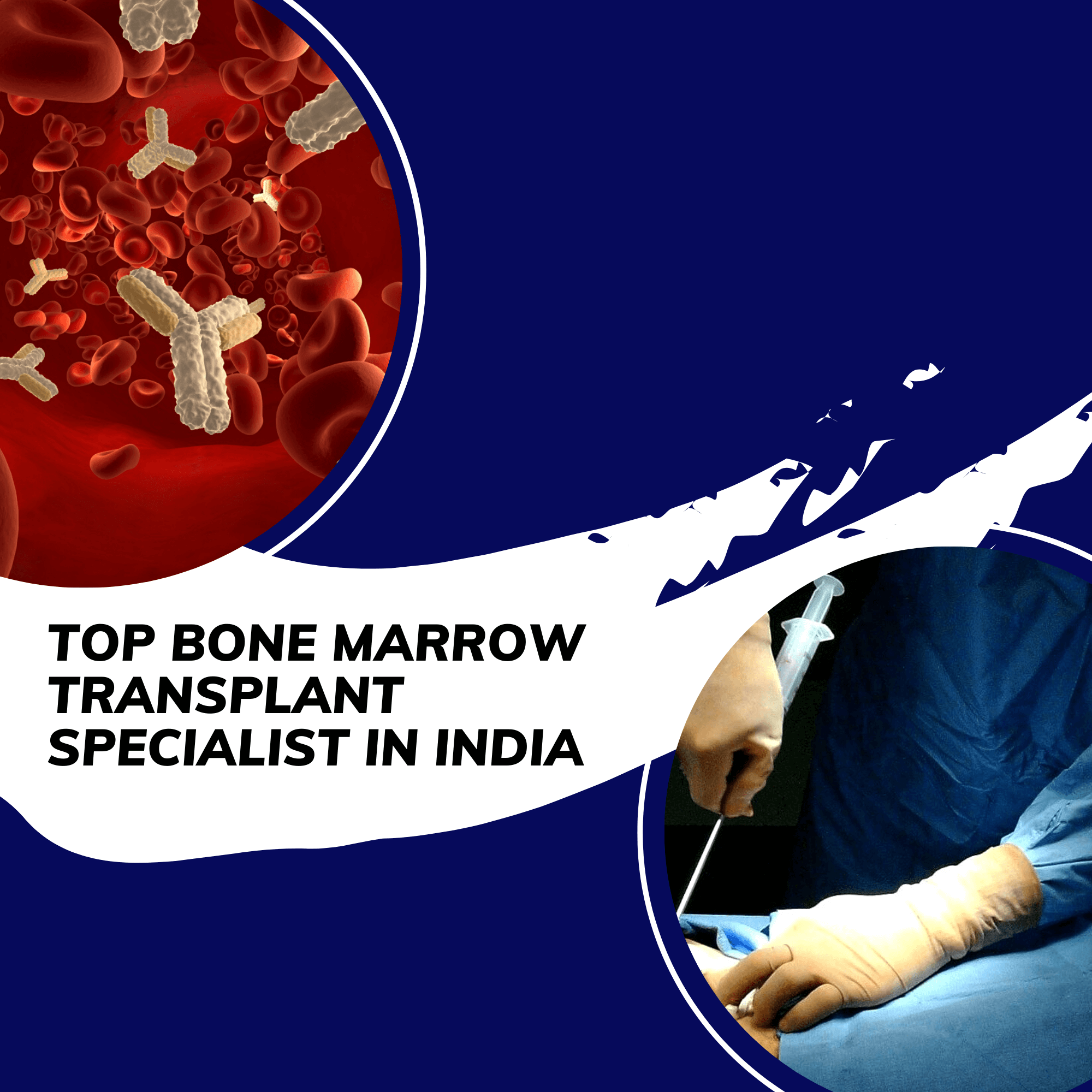 Top Bone Marrow Specialist in India